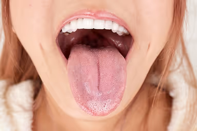 [VR] Specialized VR - Tongue - gallery