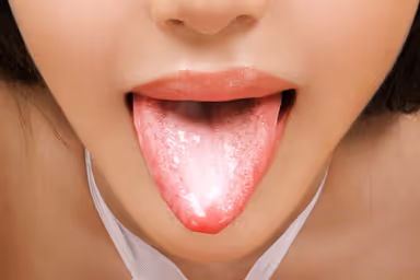 VR] The super awesome play that doesn't end until you shoot 10 times! The sex industry of the lascivious woman who pounces on your dick with a continuous attack that never stops! Rin Ouka [8K gallery